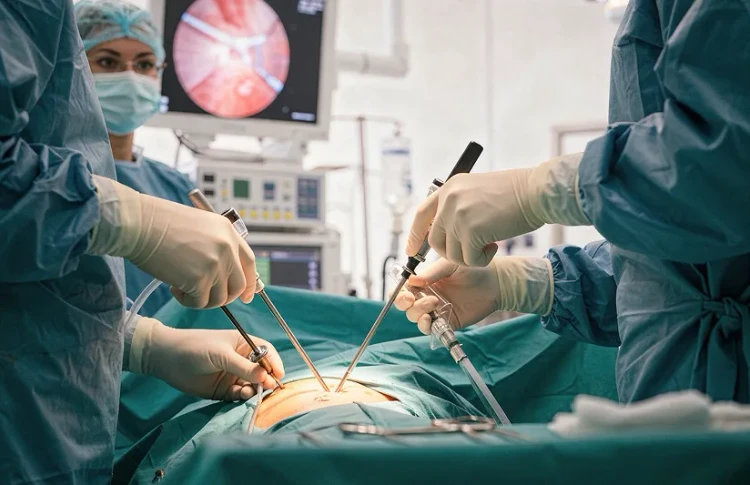 Laparoscopic Hysterectomy